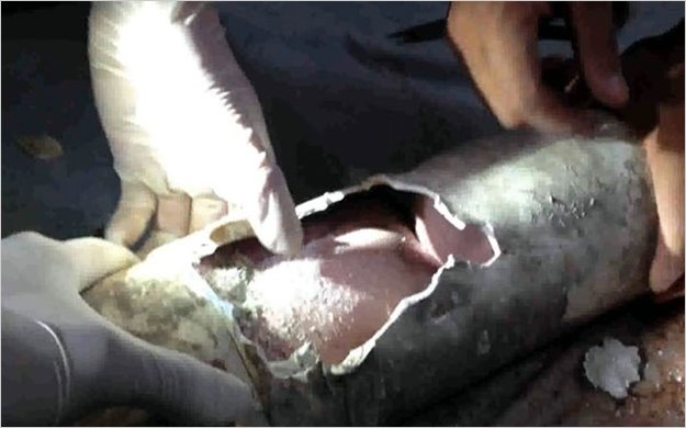 Milagro: salvan a bebÃ© arrojado a un retrete