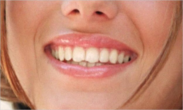 Desarrollan mÃ©todos para crear dientes nuevos en los adultos a partir de cÃ©lulas madre