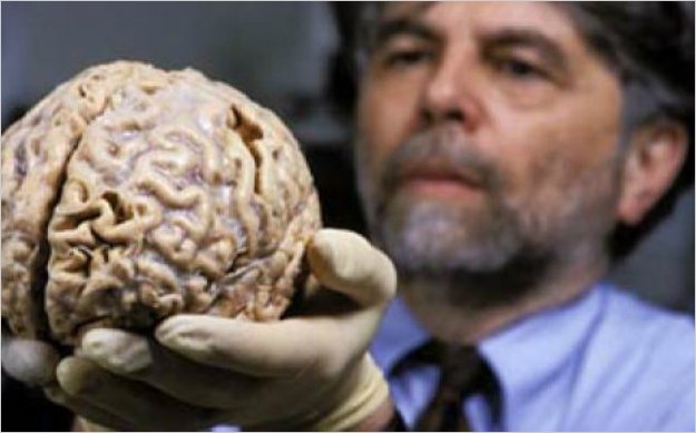 El uso de Facebook podrÃ­a cambiar la forma del cerebro