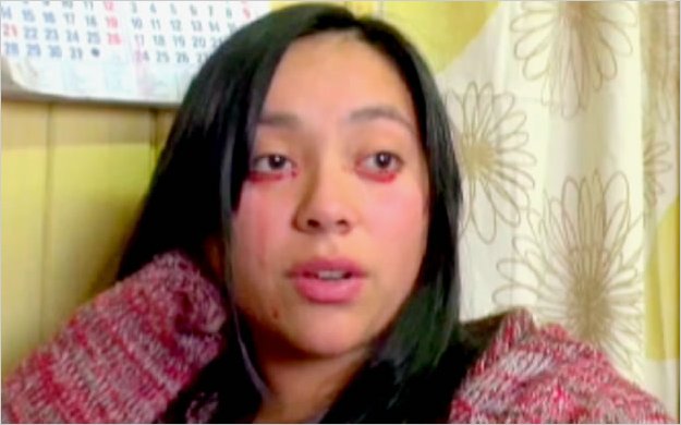 InsÃ³lito: Chica chilena que llora lÃ¡grimas de sangre