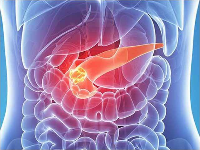 Se eliminÃ³ el cÃ¡ncer de pÃ¡ncreas en ratones