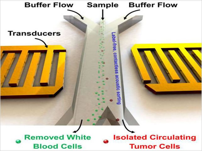 Crean un dispositivo capaz de separar las cÃ©lulas cancerosas de la sangre