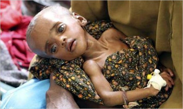En riesgo mortal 300 mil niÃ±os en Africa oriental